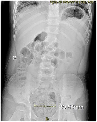 Treatment Experience of 210 Pediatric Patients With Extraordinary Daytime Urinary Frequency: A Prospective Study